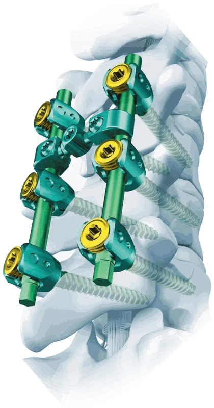 Modelo de columna con sistema de fijación